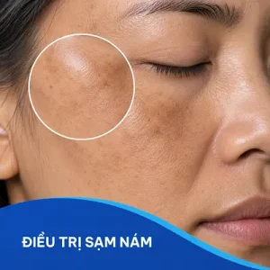 Trang chủ