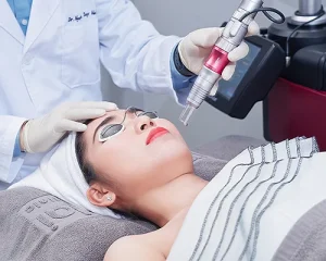 THERMAGE FLX – NÂNG CƠ TRẺ HÓA DA