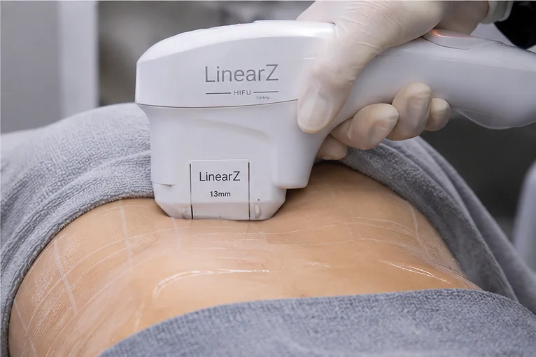 LinearZ – NÂNG CƠ TRẺ HÓA DA